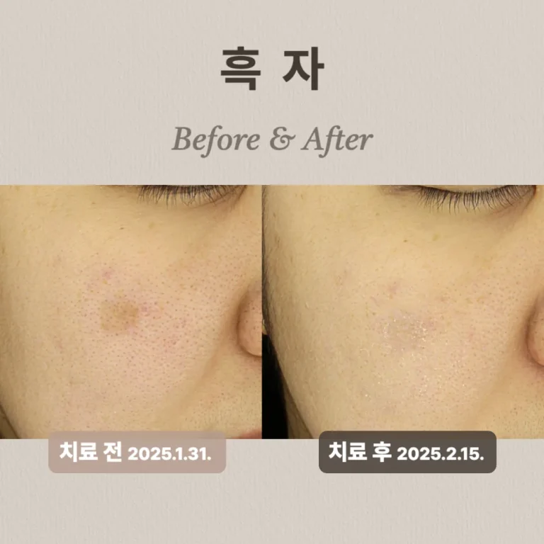 40대 여성 흑자 상담 후기