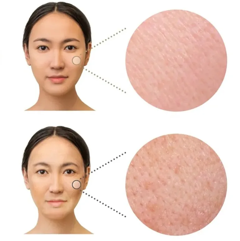수분감에 따른 피부결 비교 — 수분감이 충분한 피부와 건조한 피부의 표면 차이