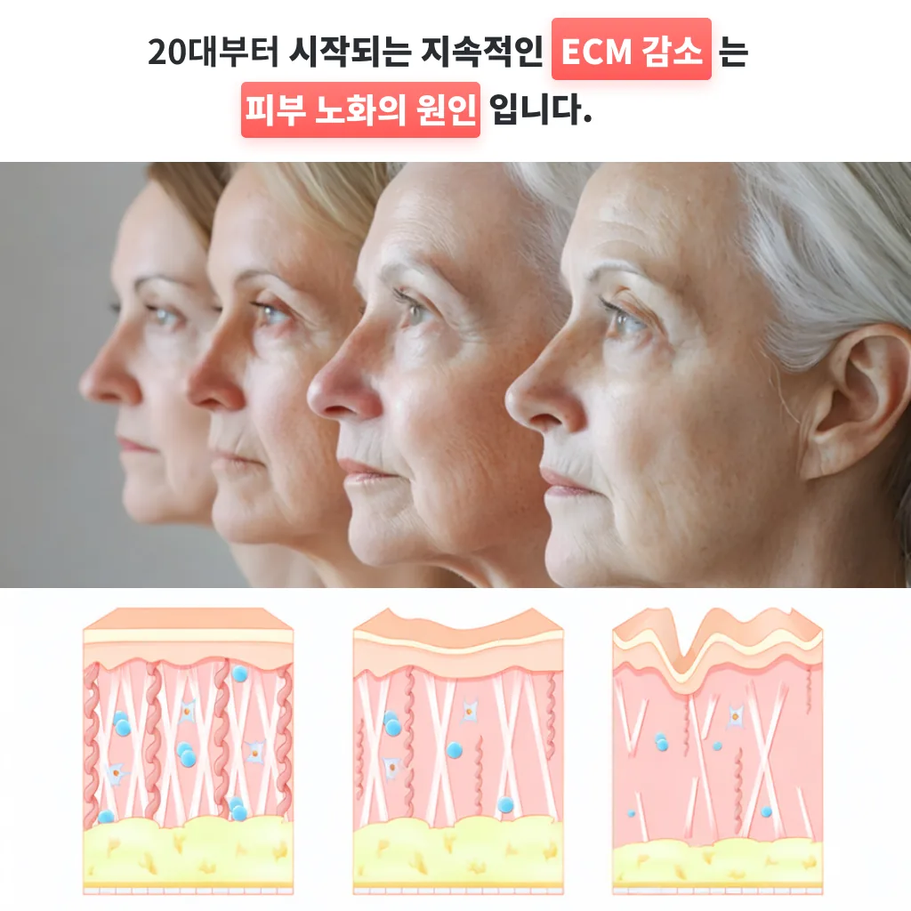 20대부터 시작되는 지속적인 ECM 감소가 피부 노화의 원인임을 보여주는 설명 이미지 — 나이에 따른 얼굴 변화와 진피 구조 단면