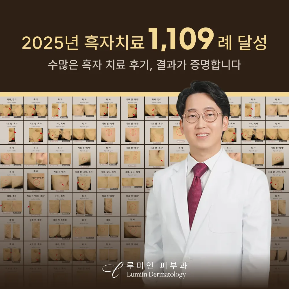 흑자 치료 후기 공유드립니다.