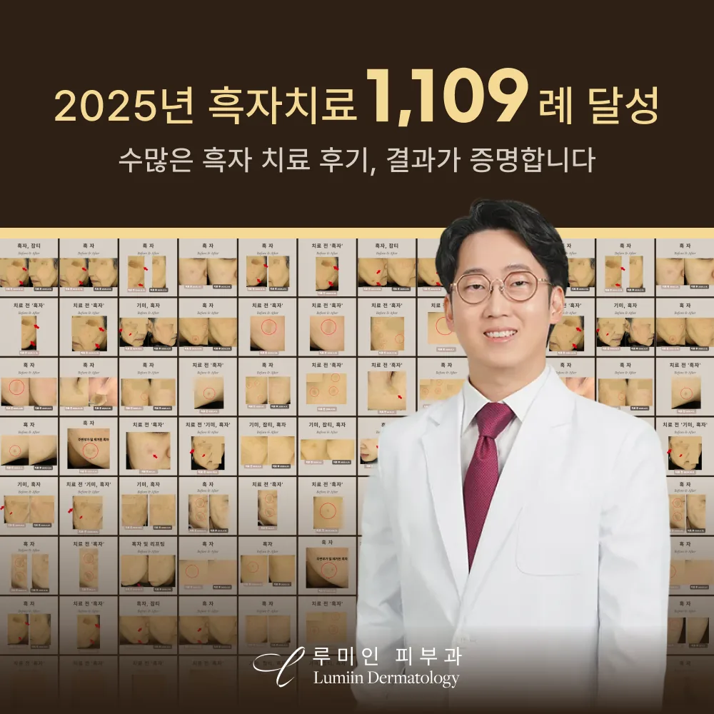 루미인피부과 2025년 흑자치료 1,109례 달성