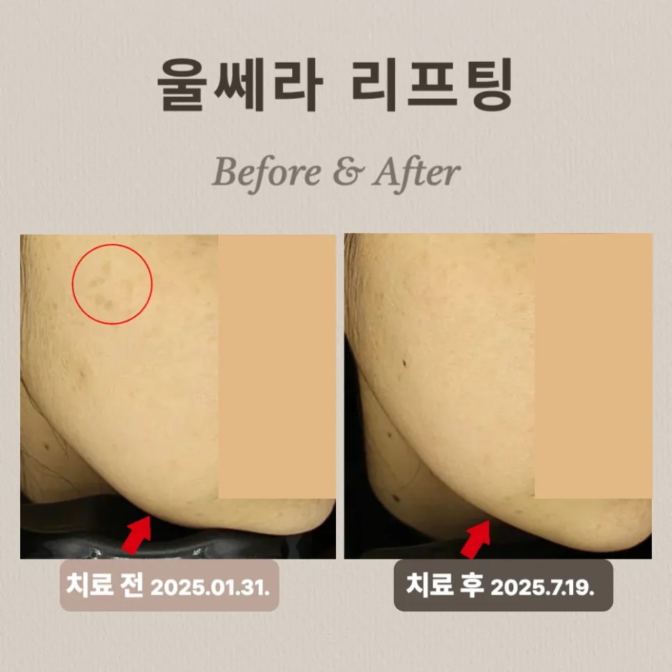 사례2
